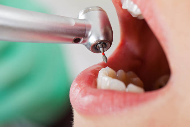 Best Emergency Pediatric Dental Care in De Kal, TX
